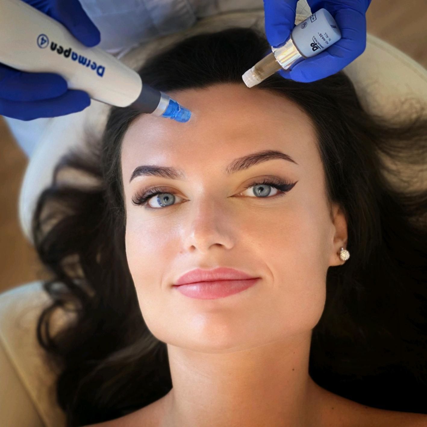 Dermapen 4 treatment