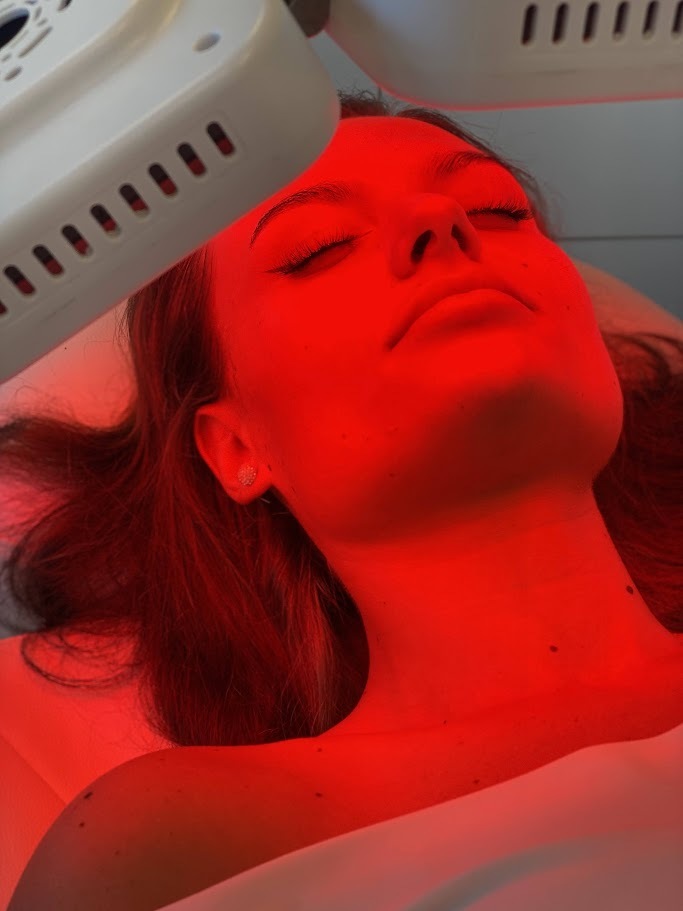 Terapia LED PDT treatment