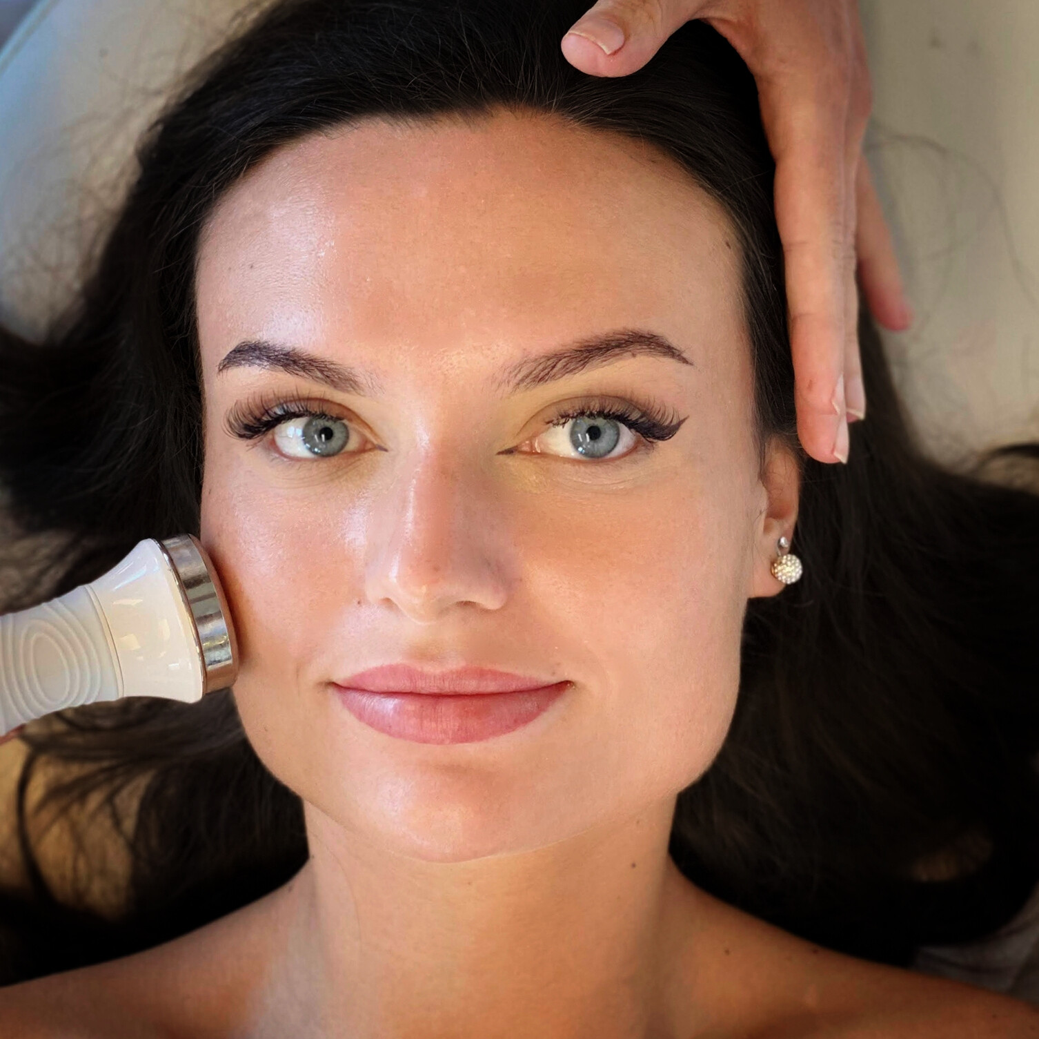 Sonoforeza treatment